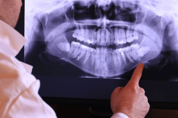 Best Broken or Cracked Tooth Emergency Dentist in Lambertville, NJ