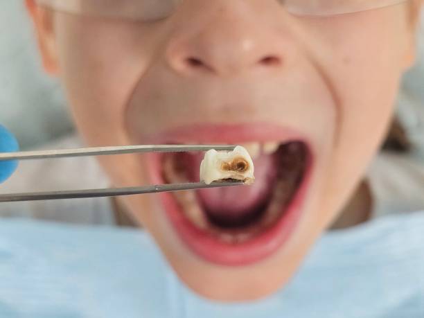 Best Pediatric Emergency Dentist in Lambertville, NJ